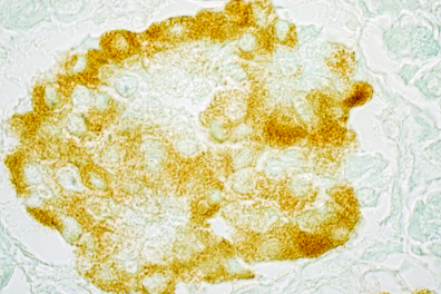 Cellules sécrétrices d'insuline - Ilôt de Langerhans du Pancréas (traitement histochimique) x100